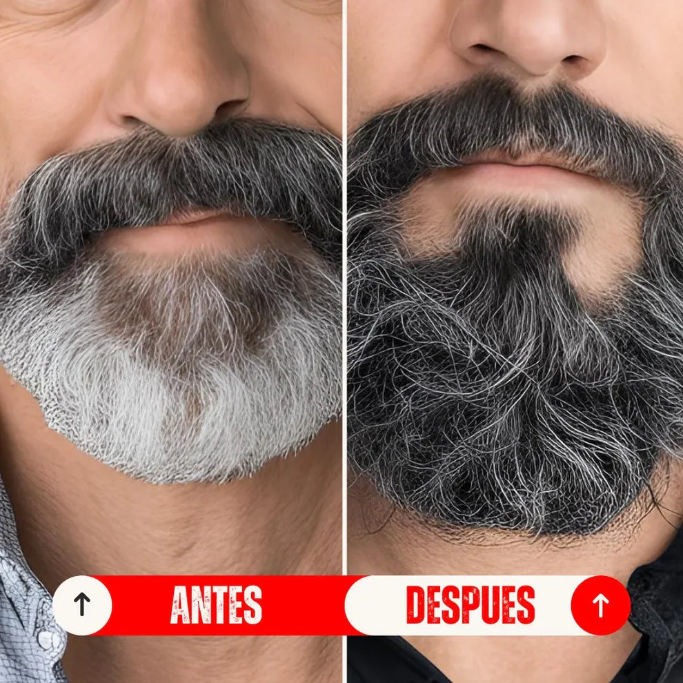 REJUVEX® BARRA DE REJUVENECIMIENTO CAPILAR -RECUPERA EL TONO NATURAL DE TU CABELLO SIN TINTES NI QUIMICOS