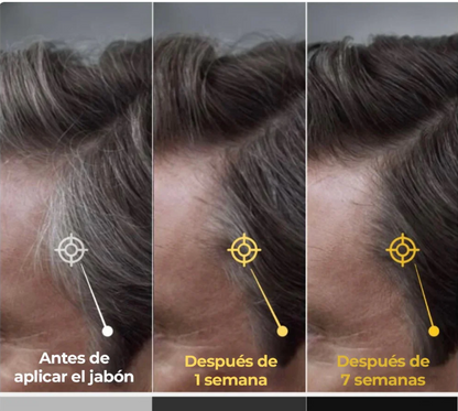 REJUVEX® BARRA DE REJUVENECIMIENTO CAPILAR -RECUPERA EL TONO NATURAL DE TU CABELLO SIN TINTES NI QUIMICOS