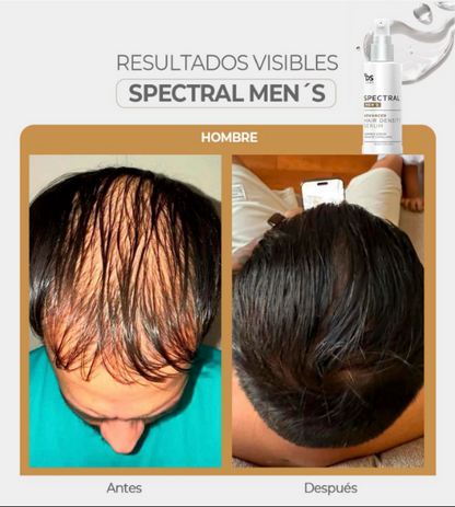 SPECTRAL DNC-N - Tecnología Nanosome® + Nanoxidil 5 %: ciencia avanzada para un cabello con más vida.