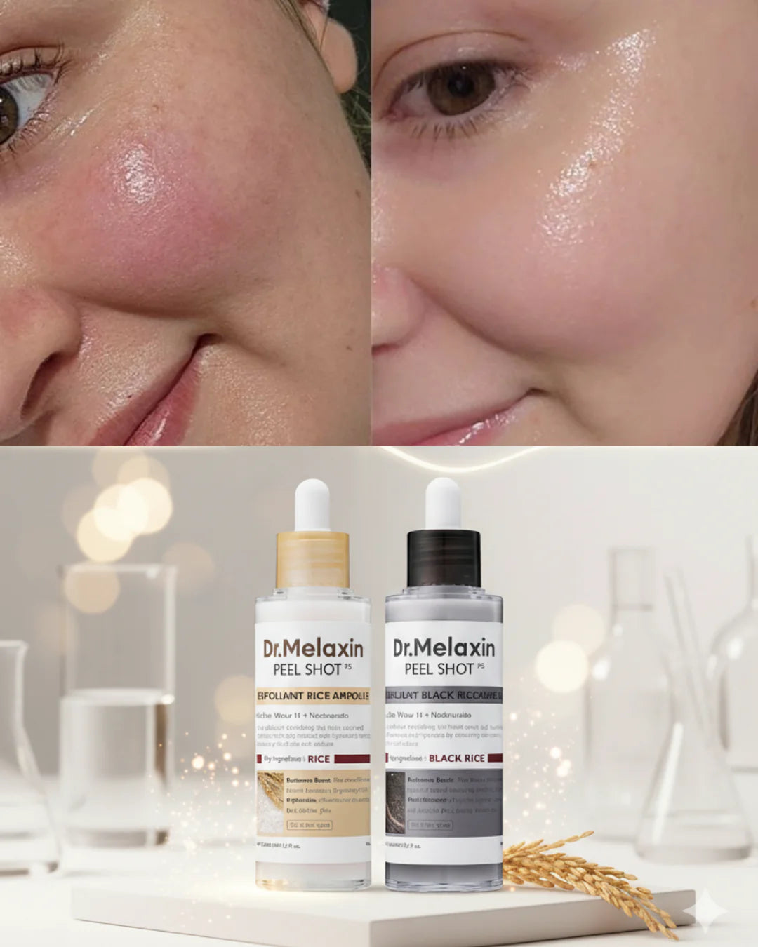 Dr. Melaxin Peel Shot Glow (COMBO) — Exfoliante inteligente que renueva tu piel y la deja con brillo de filtro natural